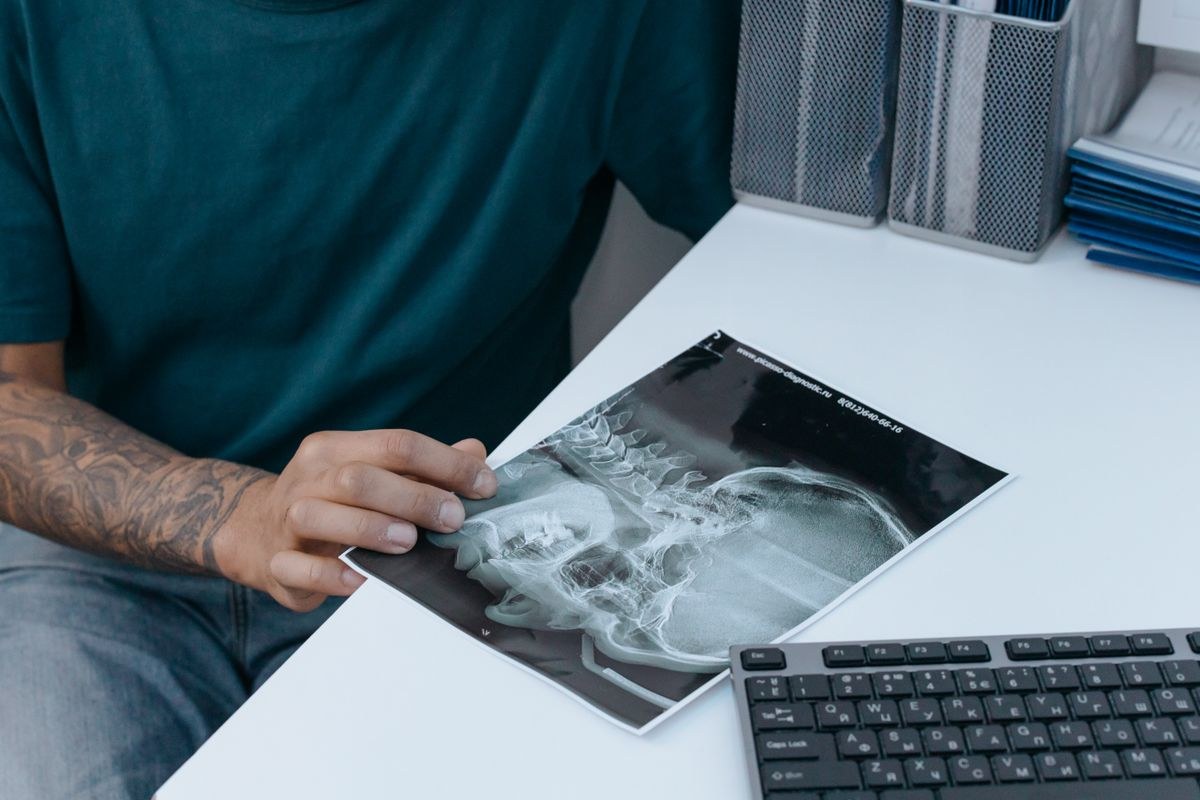Close-up of hands holding a medical X-ray film